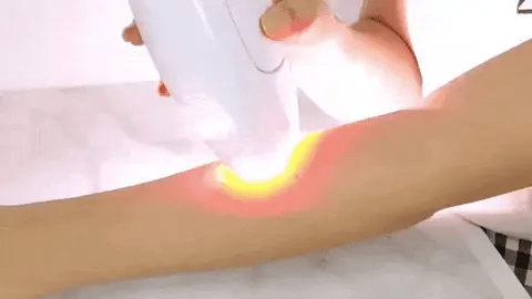 Depiladora Láser IPL Premium